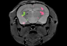 Dual-color MRI Can Track Gene Expression