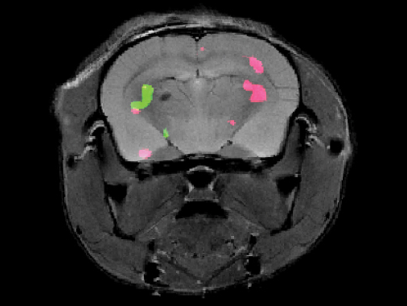 MRI دو رنگ می تواند بیان ژن را ردیابی کند