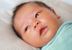 تشخیص و درمان بیلی زردی در نوزادان